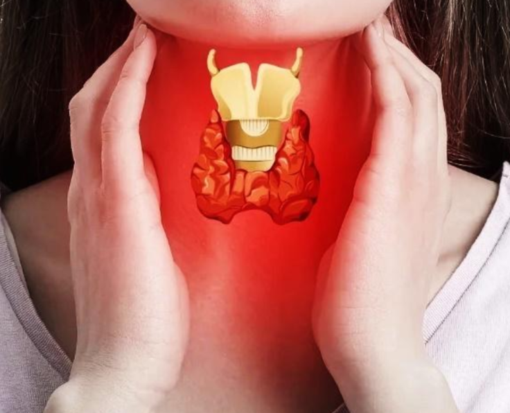 Thyroid Disorder Management 1
