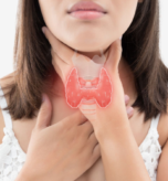 Thyroid Disorder Management 2
