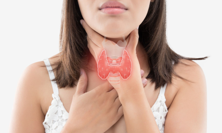 Thyroid Disorder Management 2