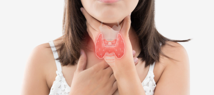 Thyroid Disorder Management 2